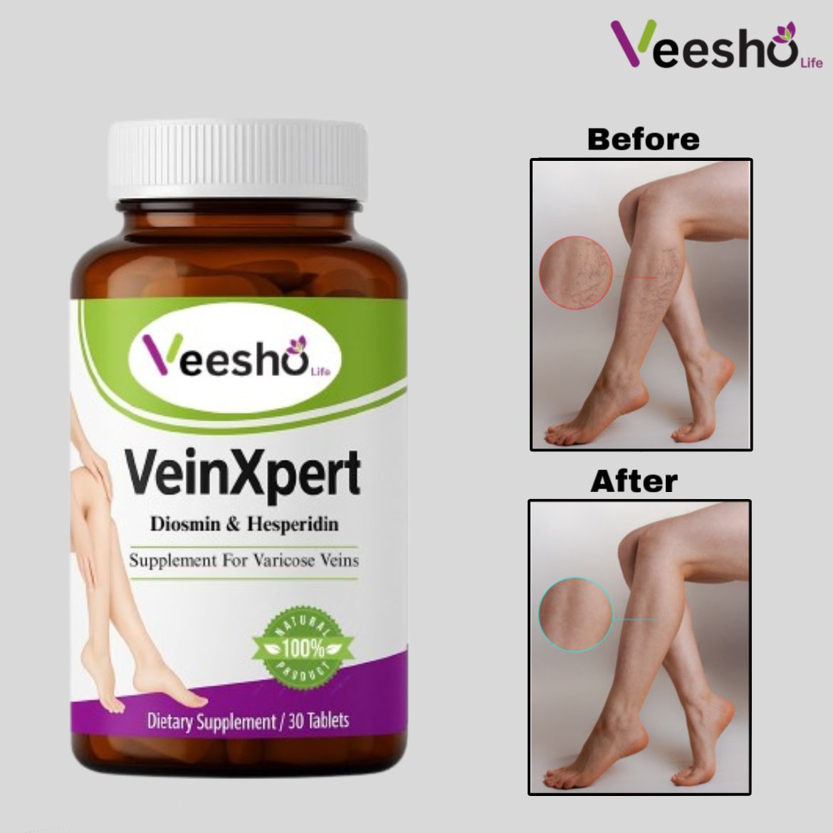 Ayurvedic Formulation VeinXpert Tablets – Spider Veins | Varicose Veins | Deep Vein Thrombosis.